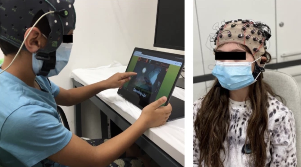 Featured image for "Revolutionary Non-Invasive Brain Stimulation Treatment Transforms Lives of Children with ADHD"