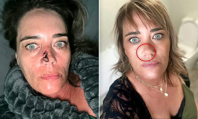 Pimple or Cancer? The Shocking Truth.