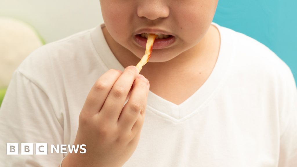 "Global Analysis: Over 1 Billion People Affected by Obesity"