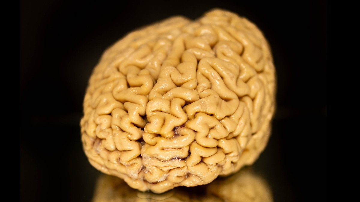 Featured image for Scientists Uncover Why 'SuperAgers' Maintain Youthful Brains