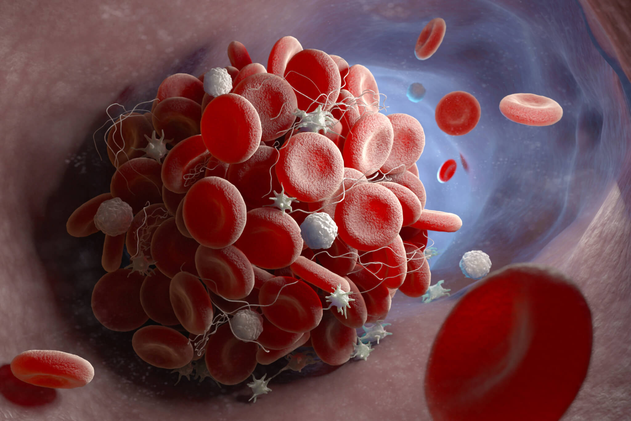 Featured image for Safe and Effective Drug Prevents Blood Clots without Bleeding Risk