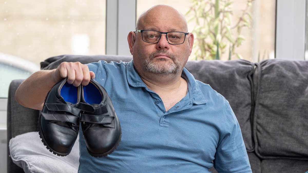 Featured image for Tight Wedding Shoes Cause Toe Amputation in Diabetic Man