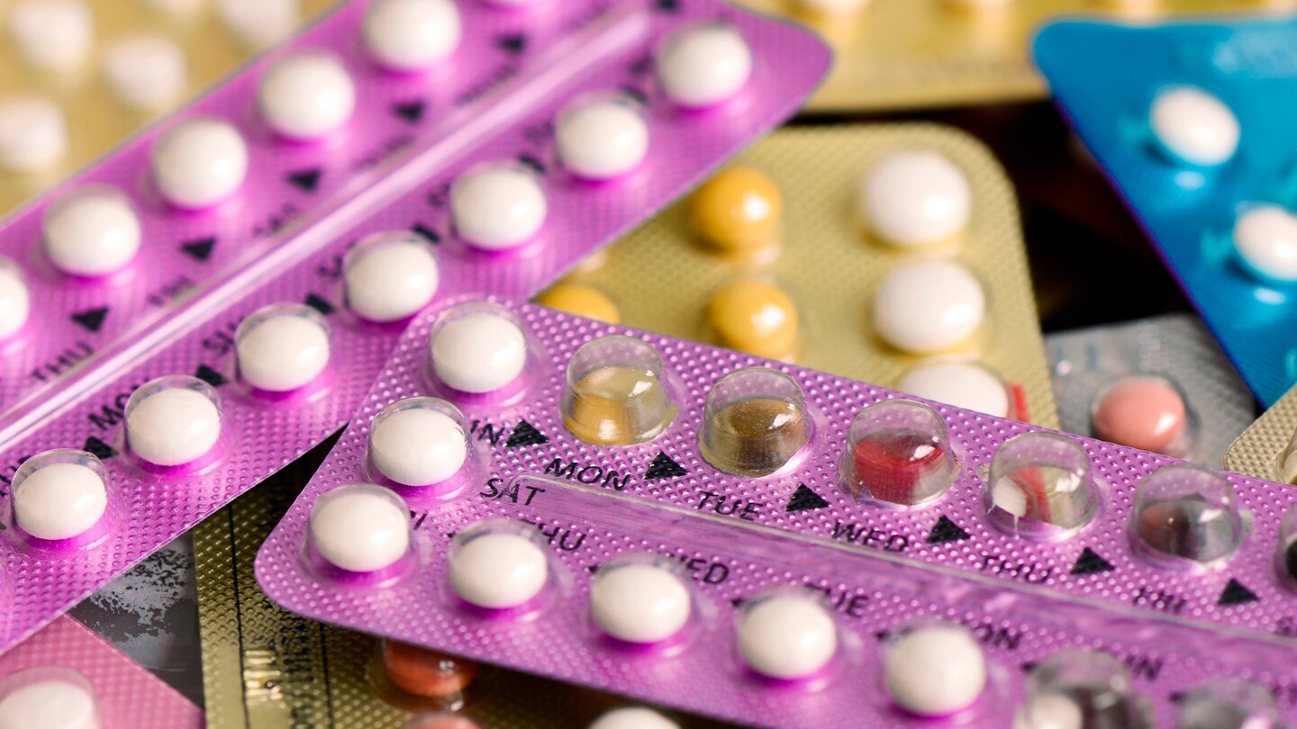 Featured image for Study finds hormonal contraceptives increase breast cancer risk.