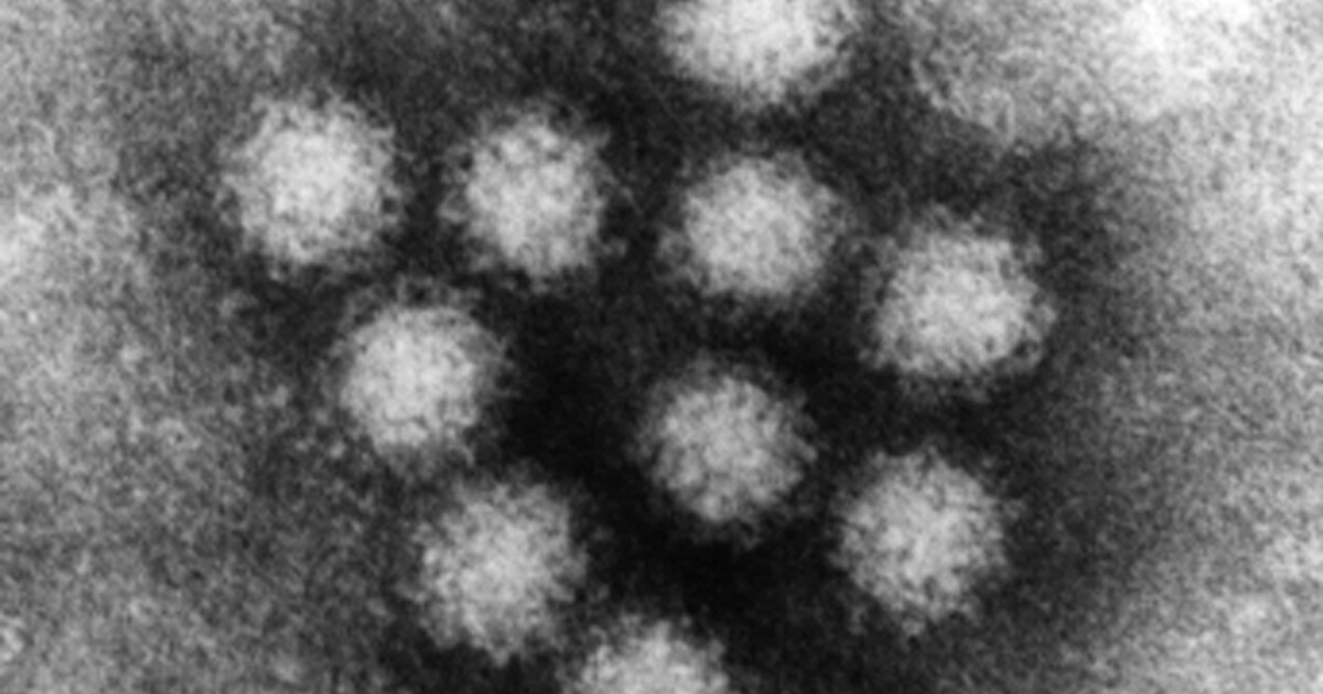 Featured image for San Luis Obispo Co. on High Alert for Norovirus Outbreak