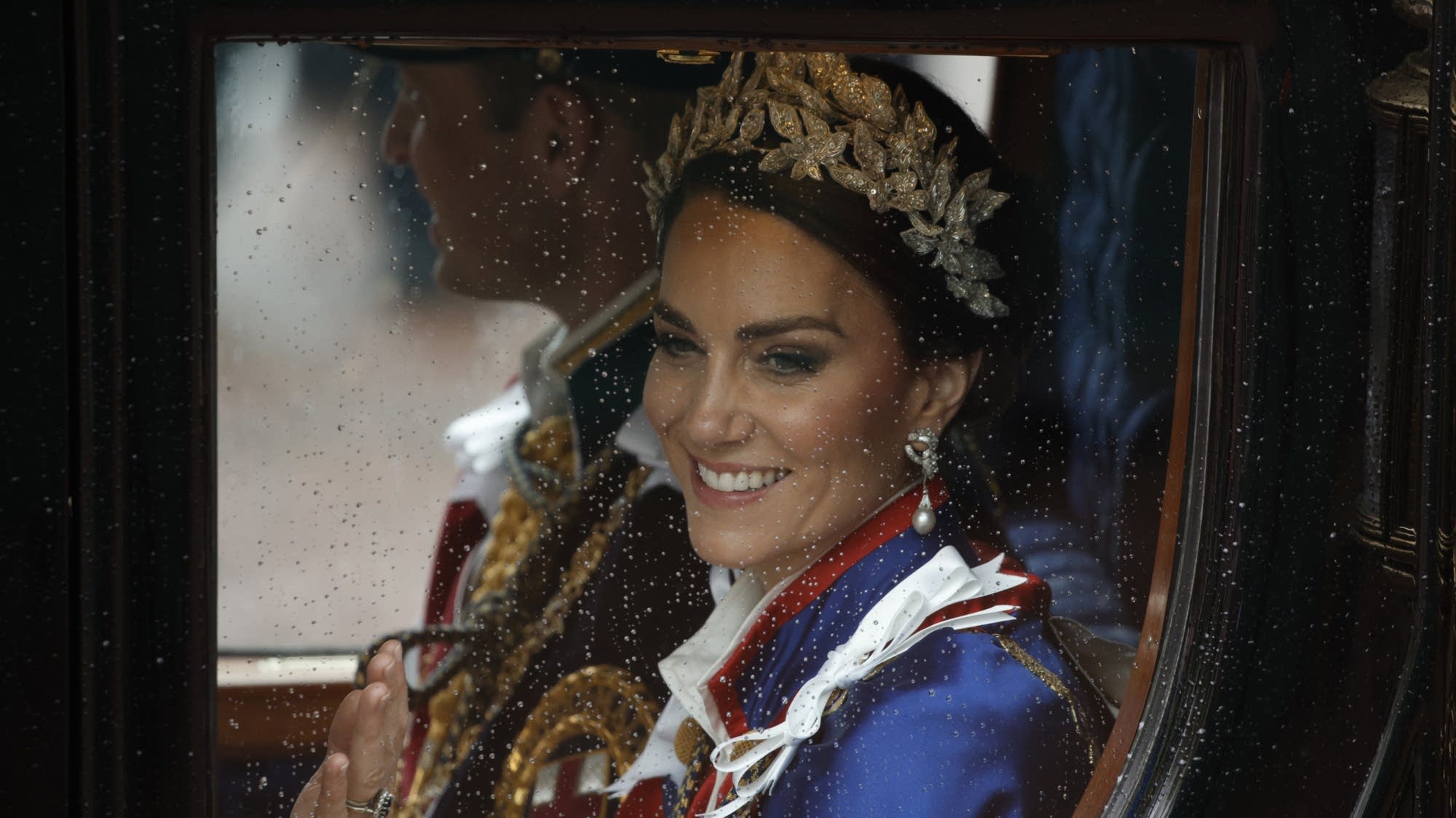 Royal Health Concerns: Kate Middleton Hospitalized for Abdominal Surgery, King Charles III to Undergo Prostate Treatment