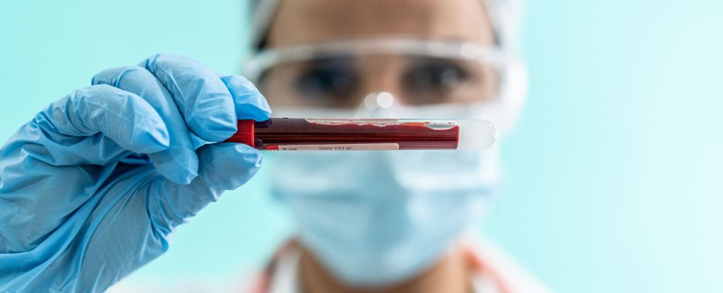 "Promising Blood Test Predicts Schizophrenia Risk and Treatment Effectiveness"