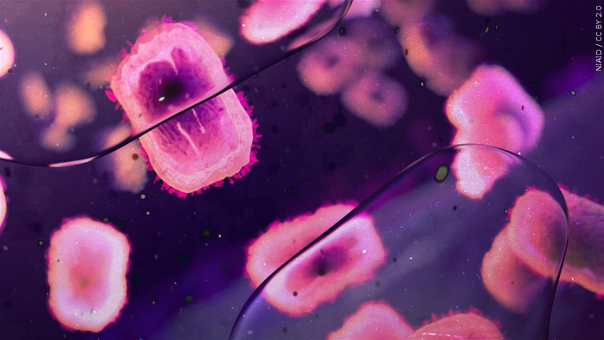 Santa Barbara County Discovers Mpox in Wastewater Sample