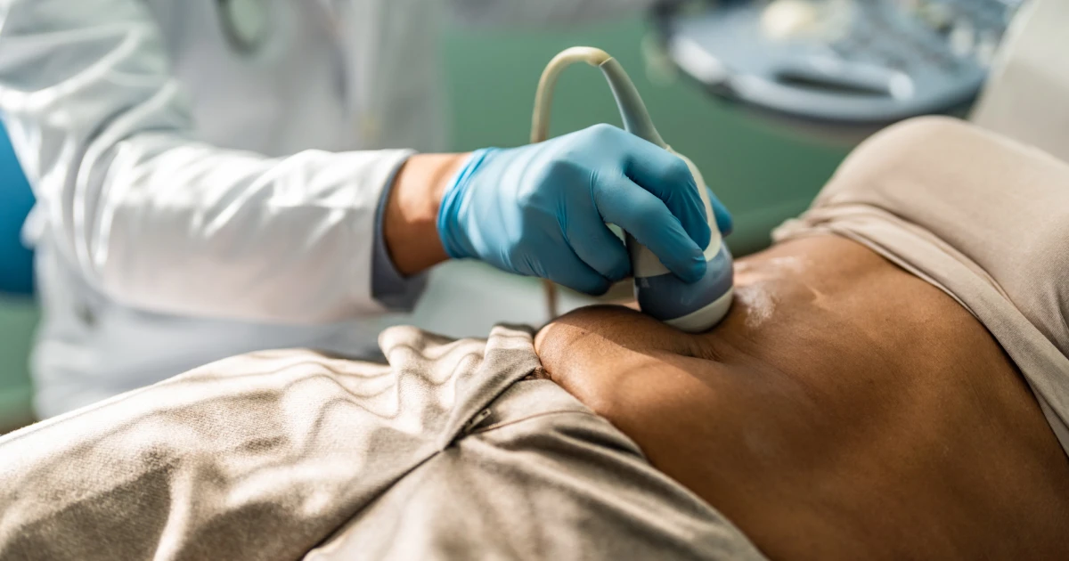 Featured image for Rising Appendix Cancers in Young Adults Alarm Researchers