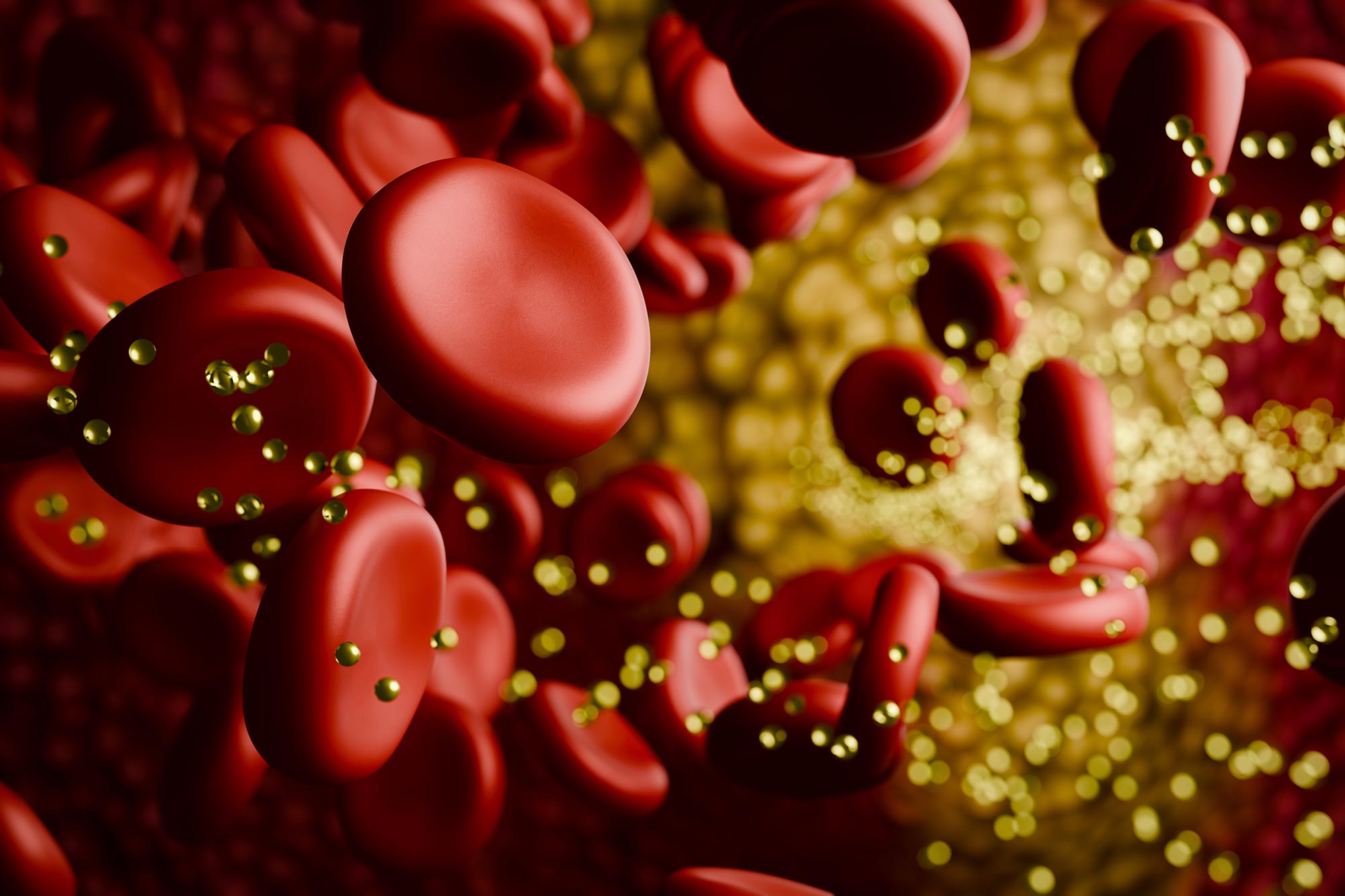 Featured image for Microplastics in Blood Vessels Linked to Heart Disease