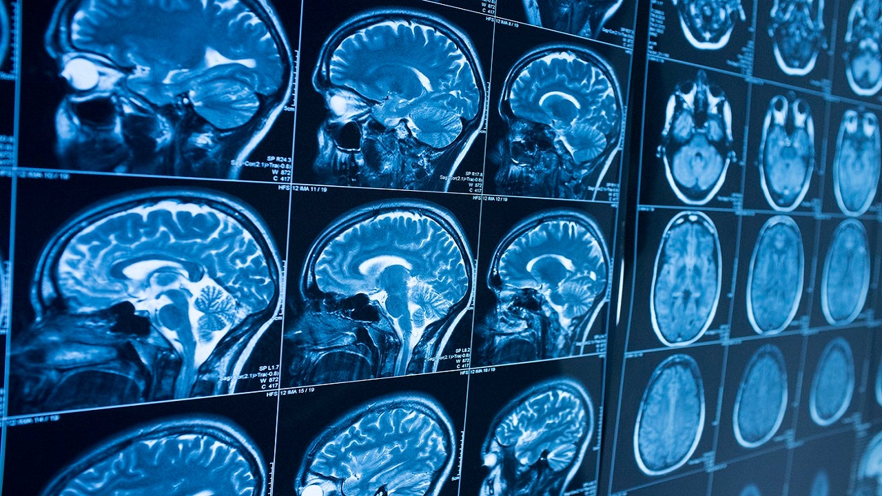 The Growing Role of Artificial Intelligence in Healthcare