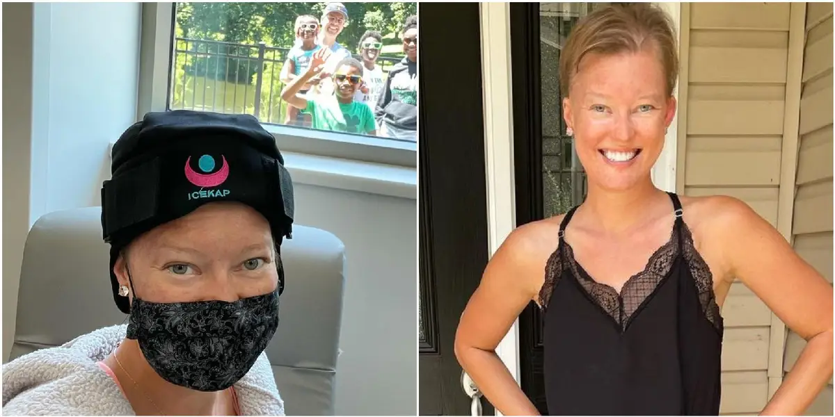 Going Bald: My Choice After Breast Cancer Treatment.