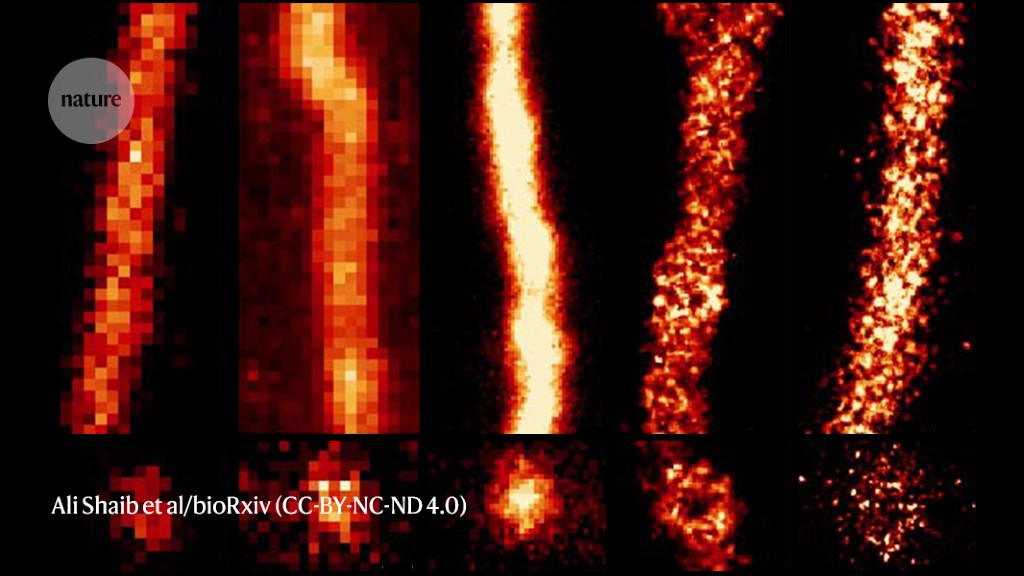 Featured image for Affordable Microscope Delivers High-Resolution Images for Democracy in Microscopy