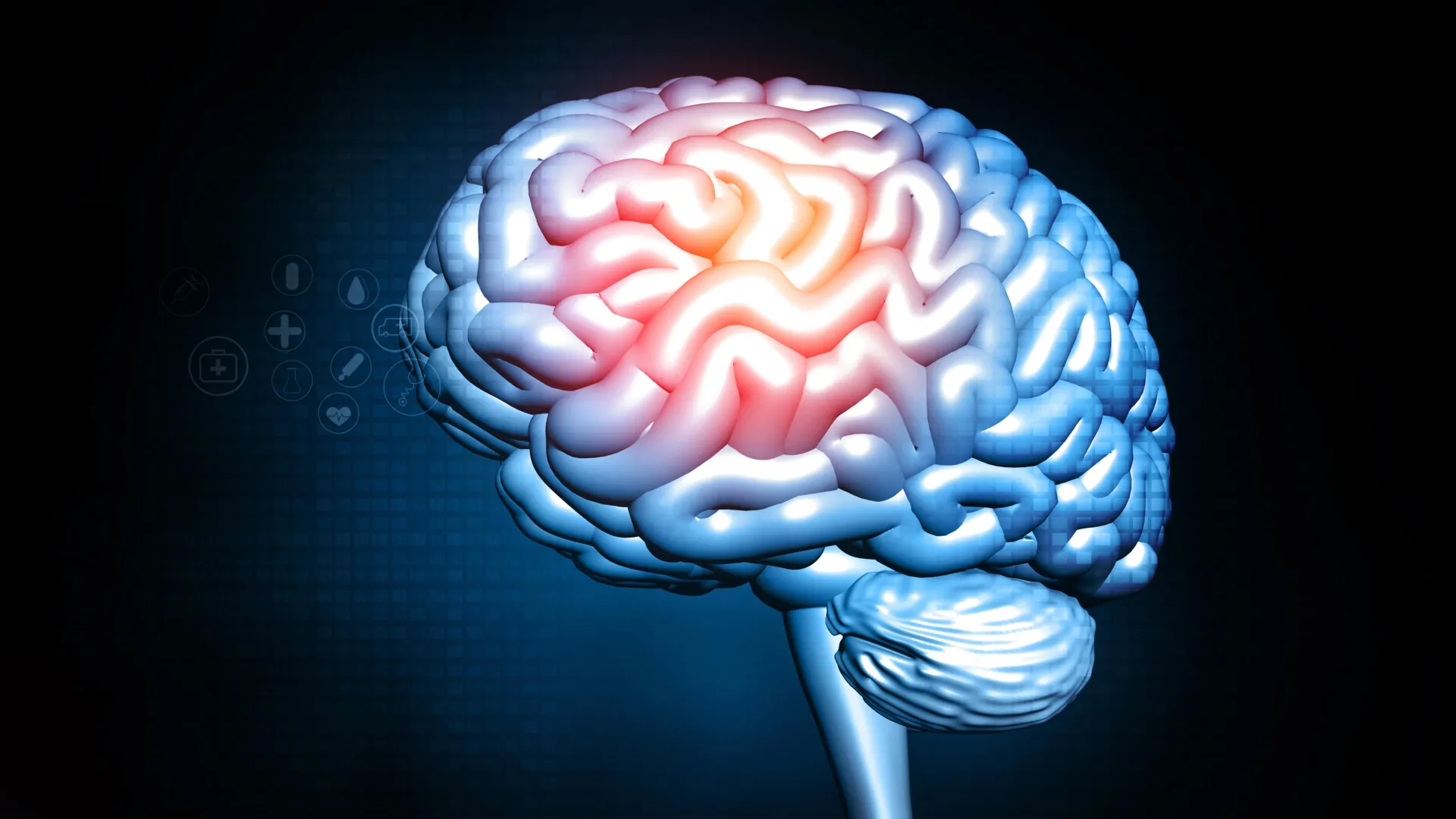 Featured image for Midlife Weight Loss Could Impact Brain Health