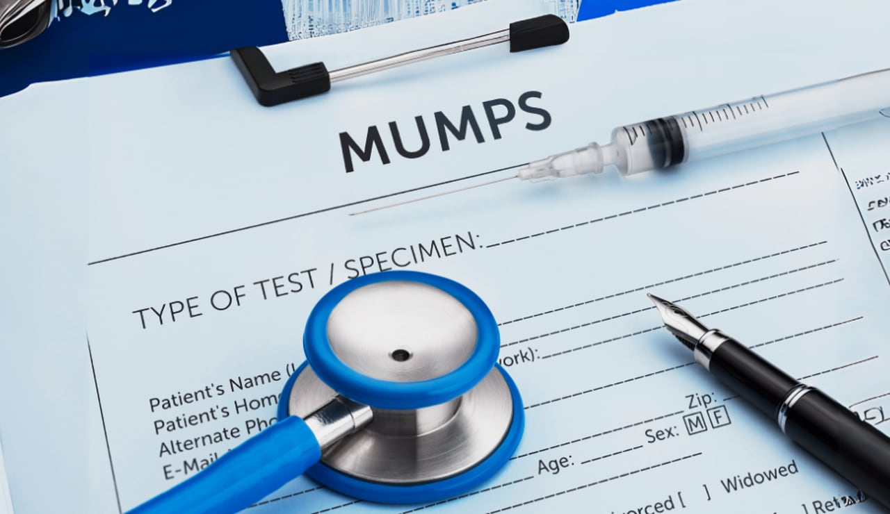 Featured image for "New Jersey Issues Warning as Mumps Cases Suspected"