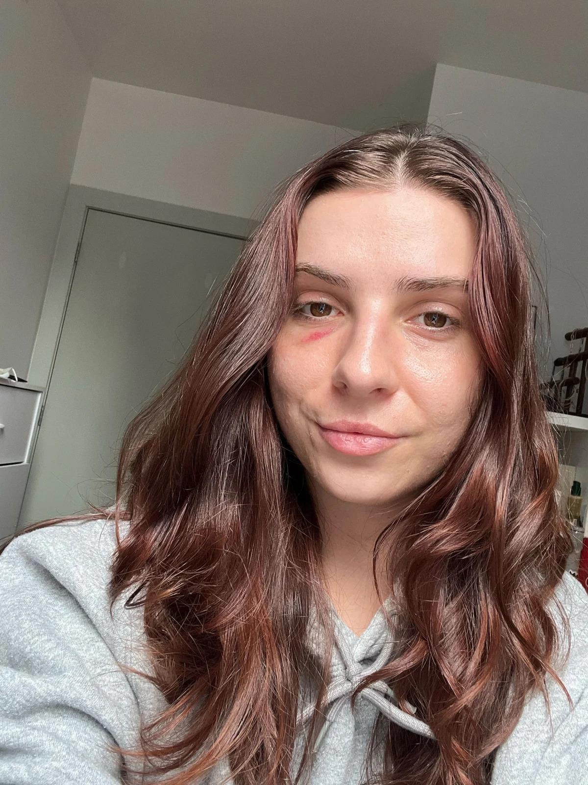 "TikTok Trend: Survivors Share Stories of Overcoming Assault"