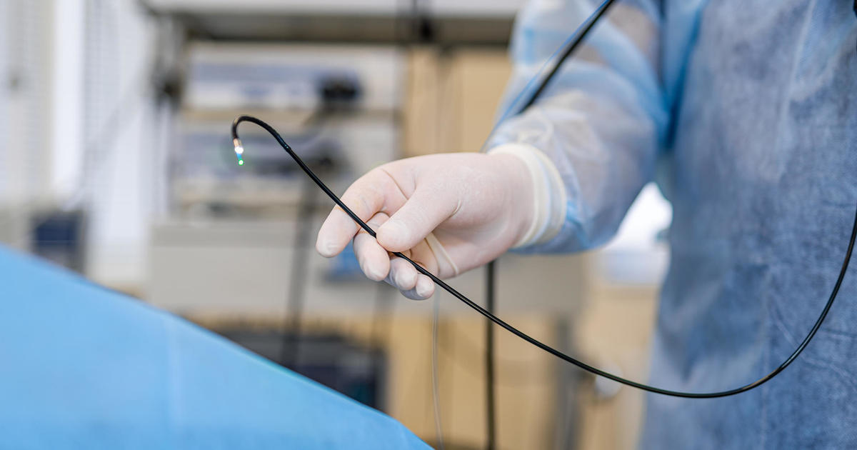 Key Questions to Ask Your Doctor Before a Colonoscopy