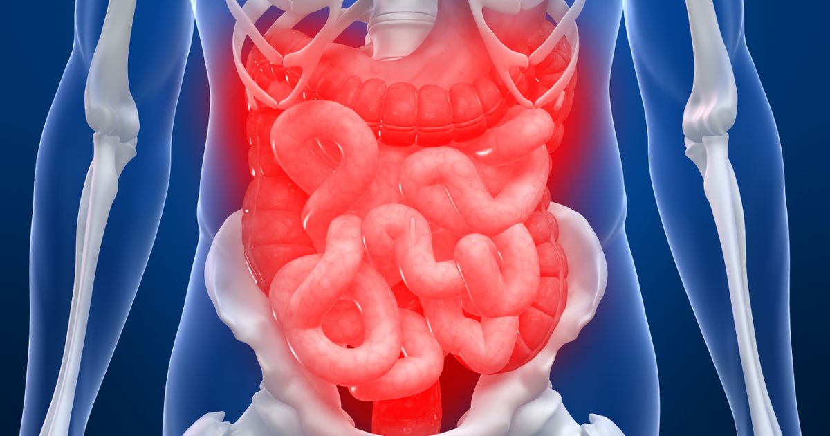 Featured image for Breakthrough Drug Brings Hope for Crohn's-Free Future