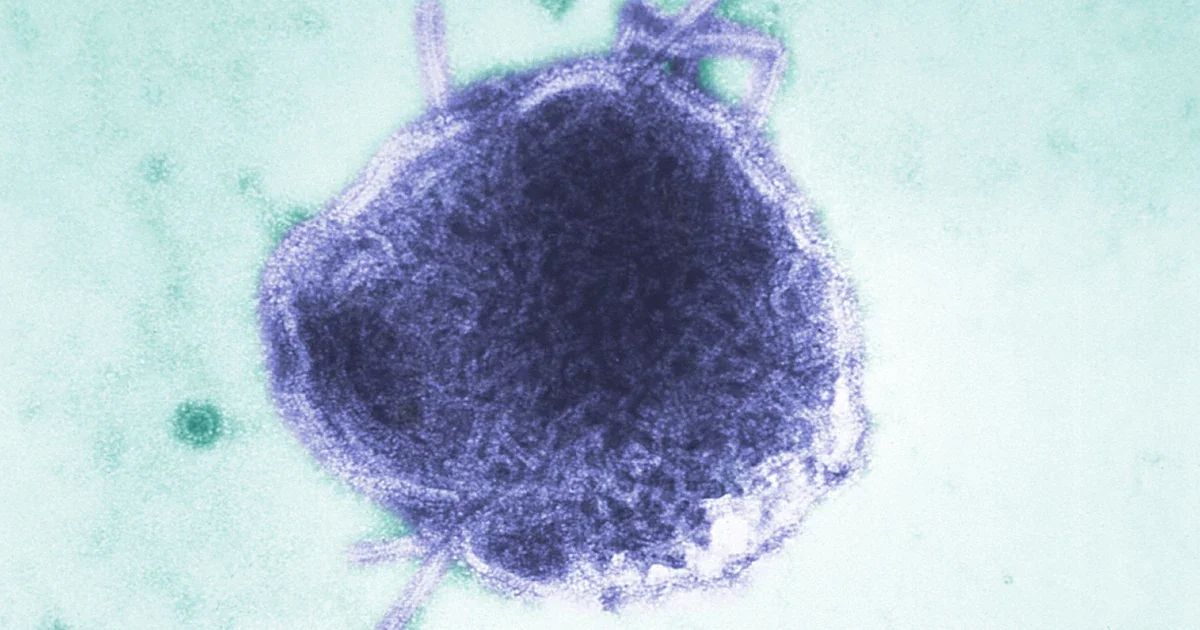 US Measles Outbreaks Reach 33-Year High, Prompting Vaccination Calls