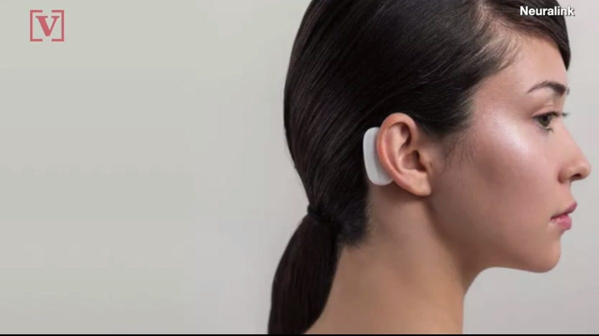 "Neuralink's Human Clinical Trial: Sign Up Now to Have Elon Musk in Your Head"