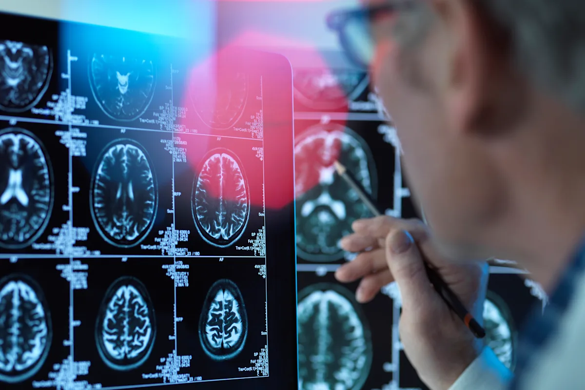 Factors influencing obesity in men and women revealed by brain scans.