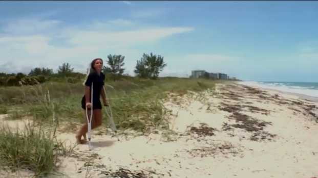 Featured image for 13-year-old girl survives shark attack in Florida