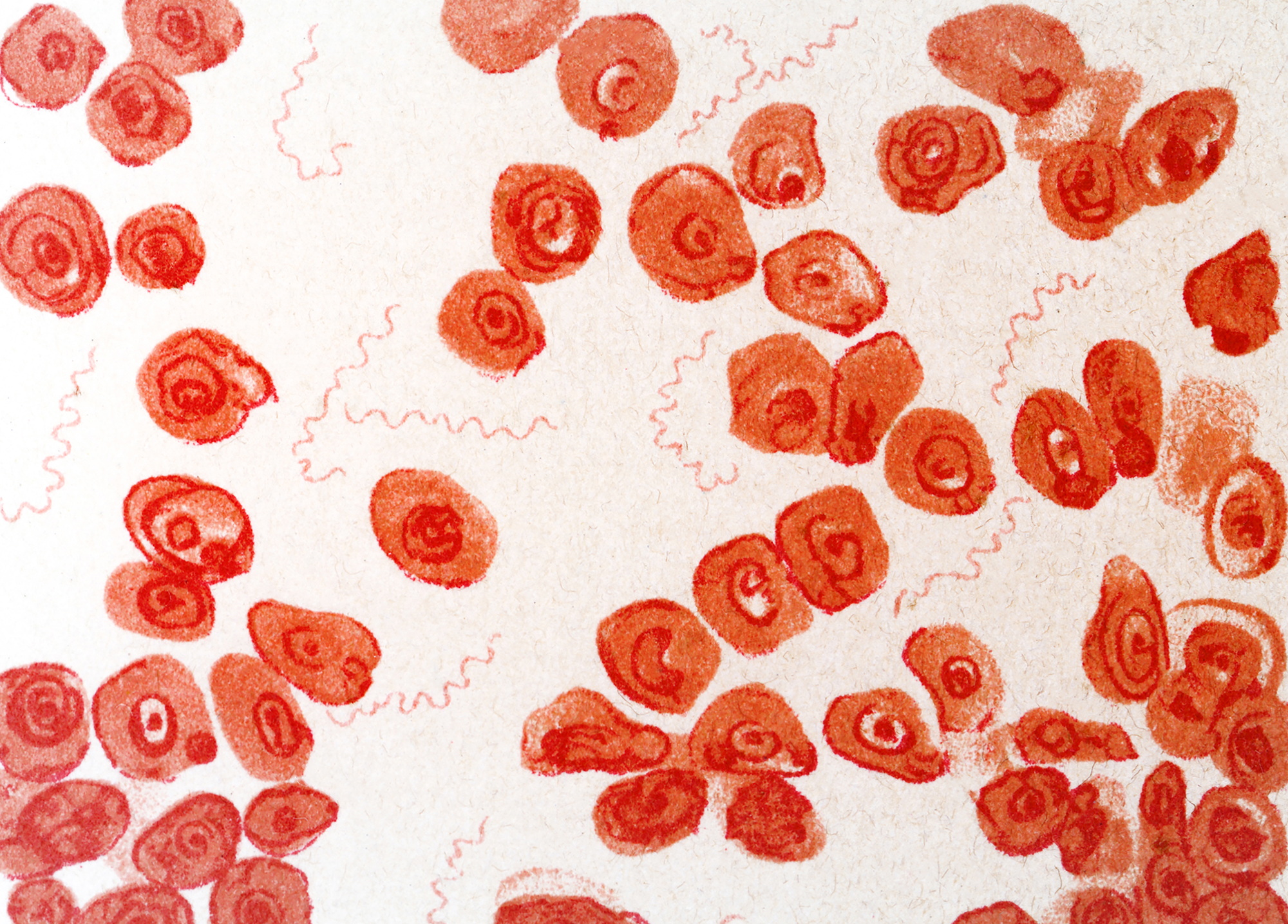 Featured image for The Looming Threat: Reemergence of Forgotten Diseases in a Warming Climate