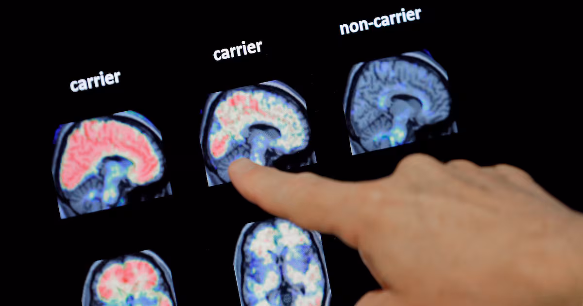 Featured image for Boost Brain Health and Reduce Dementia Risk with Simple Habits and Exercise