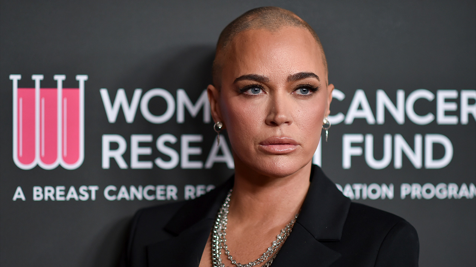 Featured image for Encino residents demand action after 'American Idol' executive and husband are murdered