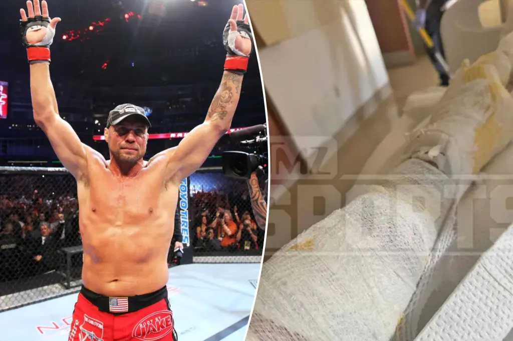 Featured image for UFC Legend Randy Couture Airlifted to Burn Center After Race Crash