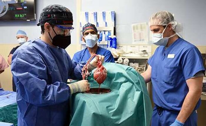 Genetically Modified Pig Heart Transplant Reveals Lessons in Xenotransplantation