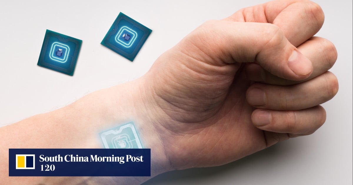 Featured image for "Revolutionary Wireless Charger Implanted Inside Humans Developed by Chinese Scientists"