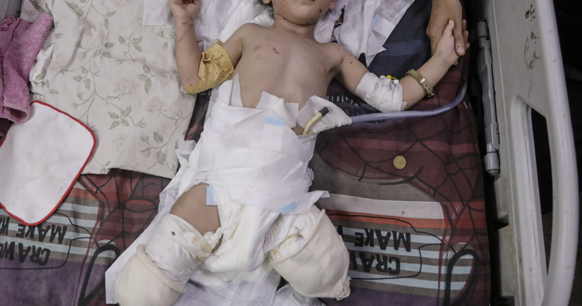 Gaza Crisis: Rising Malnutrition and Devastation Amid Ongoing Conflict