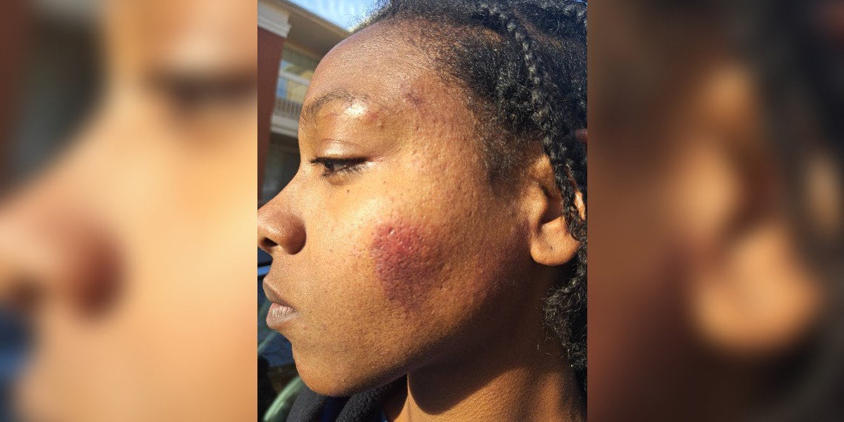 Featured image for Eyewitness Account: CMPD Officer Allegedly Punches Woman in Face During Arrest