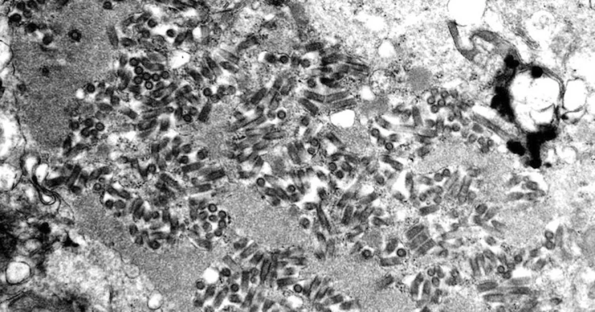 "Flathead County Reports First Rabid Bat of the Season"