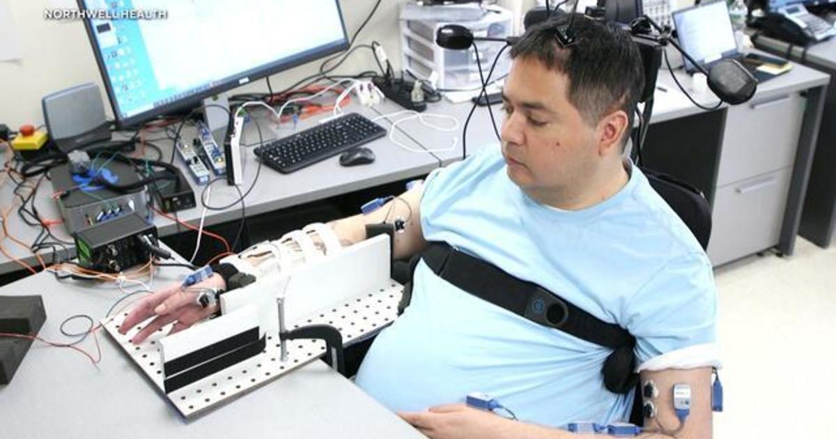 Revolutionary Brain Implants Restore Hope and Mobility for Paralyzed Man