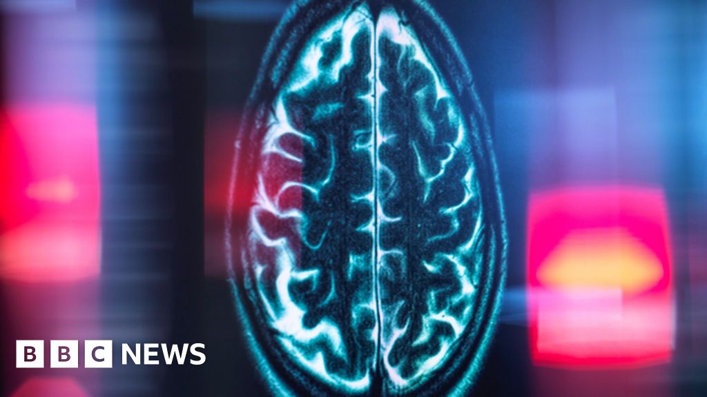 Scientists Discover Brain's Internal Mileage Counter