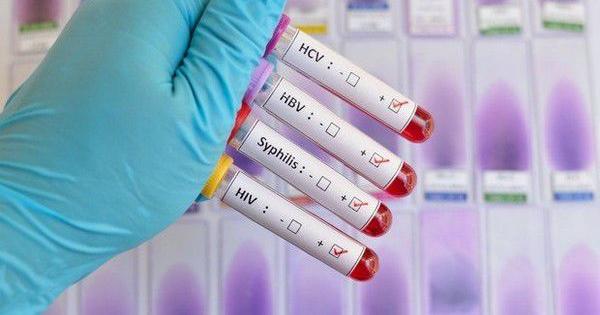 STD Crisis: Syphilis Surges to Decades-High Levels in the U.S.