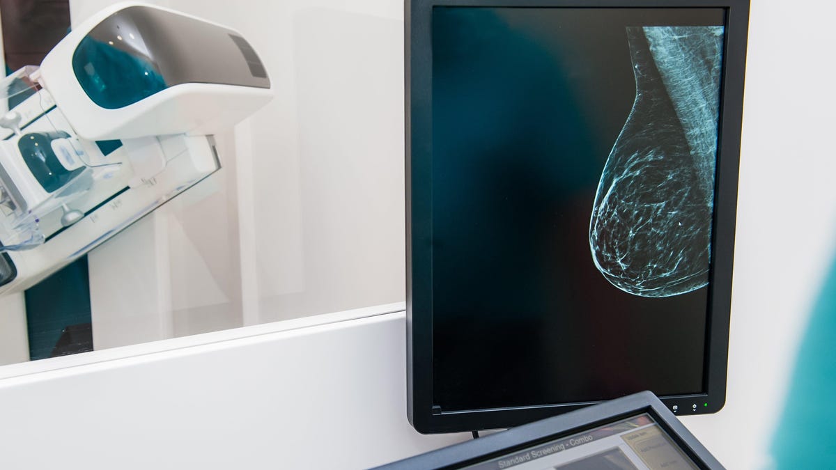 Featured image for Overdiagnosis of Breast Cancer in Older Women Raises Concerns