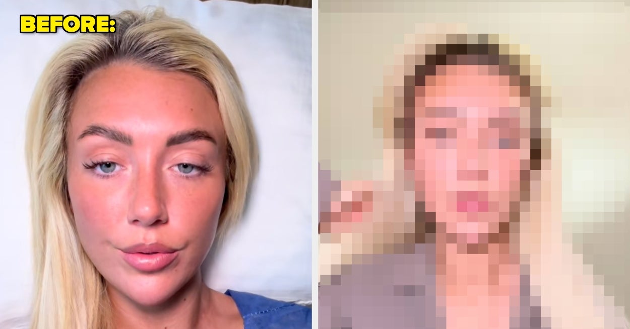 Featured image for Love Island Star's Fox Eye Surgery Results Stun Fans