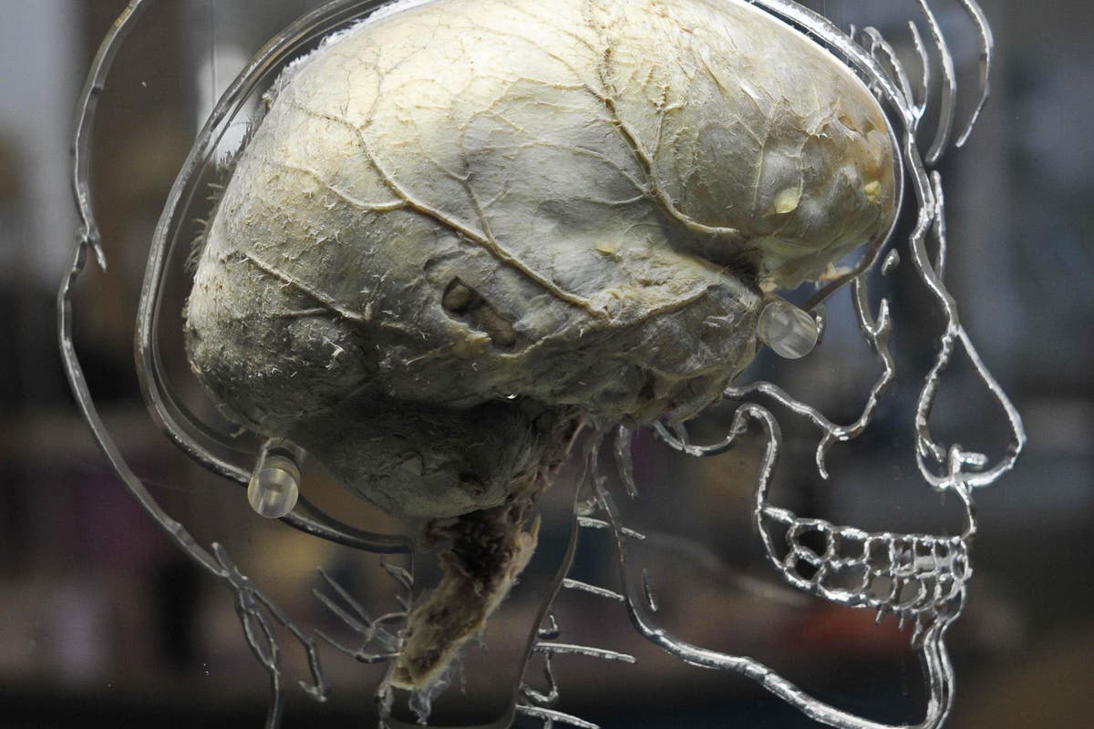 Featured image for "Early Warning: Spatial Navigation Issues Linked to Alzheimer's Risk"