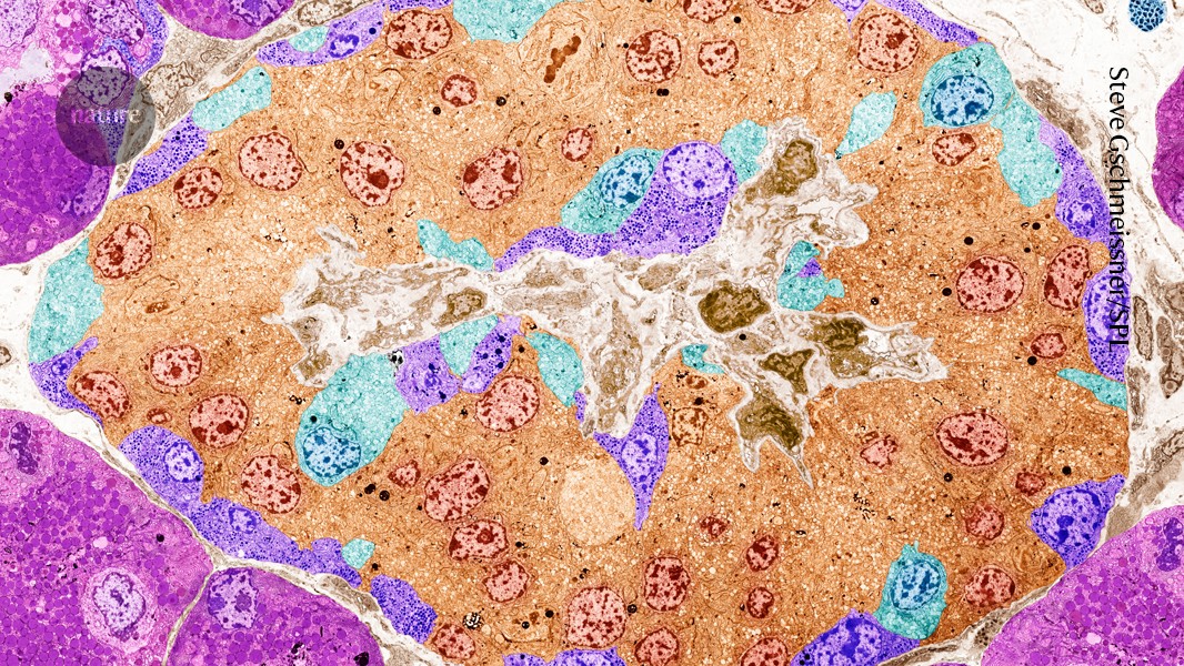 Featured image for Breakthrough in Diabetes Treatment: CRISPR and Bioengineering Enable Immune-Evasive Insulin-Producing Cells