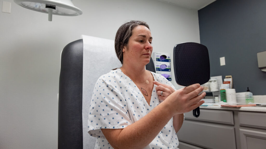 Featured image for Revolutionizing Cancer Care: Tattoo-Free Radiation Therapy