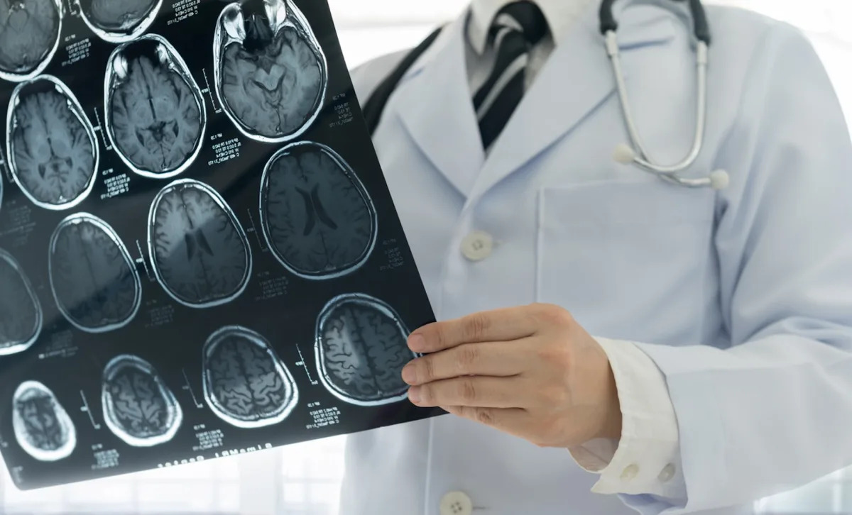 Unveiling the Hidden Dangers of Nanoplastics in Relation to Parkinson's Disease