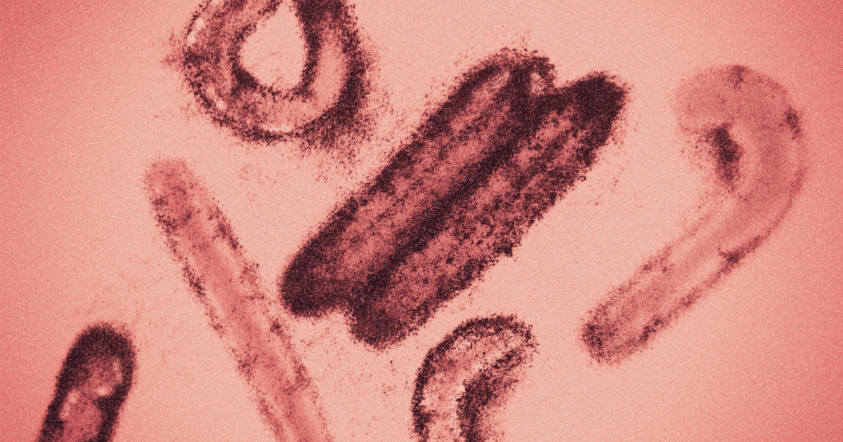 Featured image for Unveiling the Marburg Virus: 5 Crucial Facts to Understand