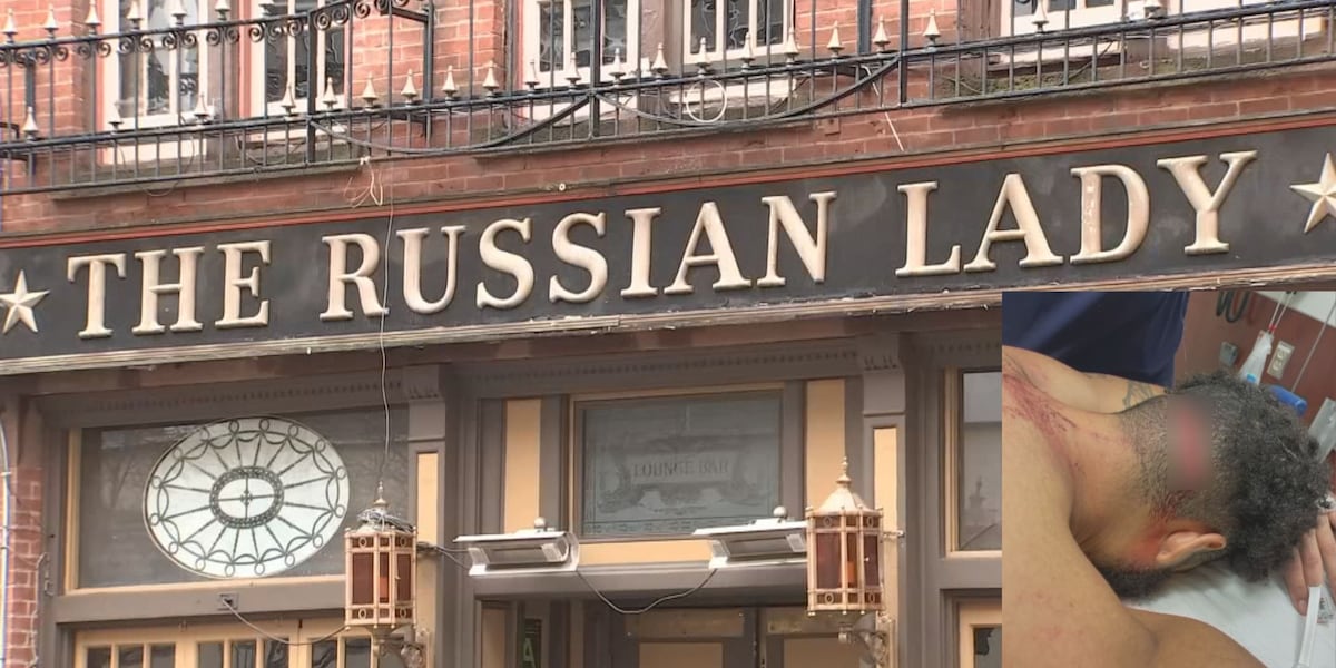 Featured image for Lawsuit Filed Against Russian Lady Nightclub Over Viral Video Injury