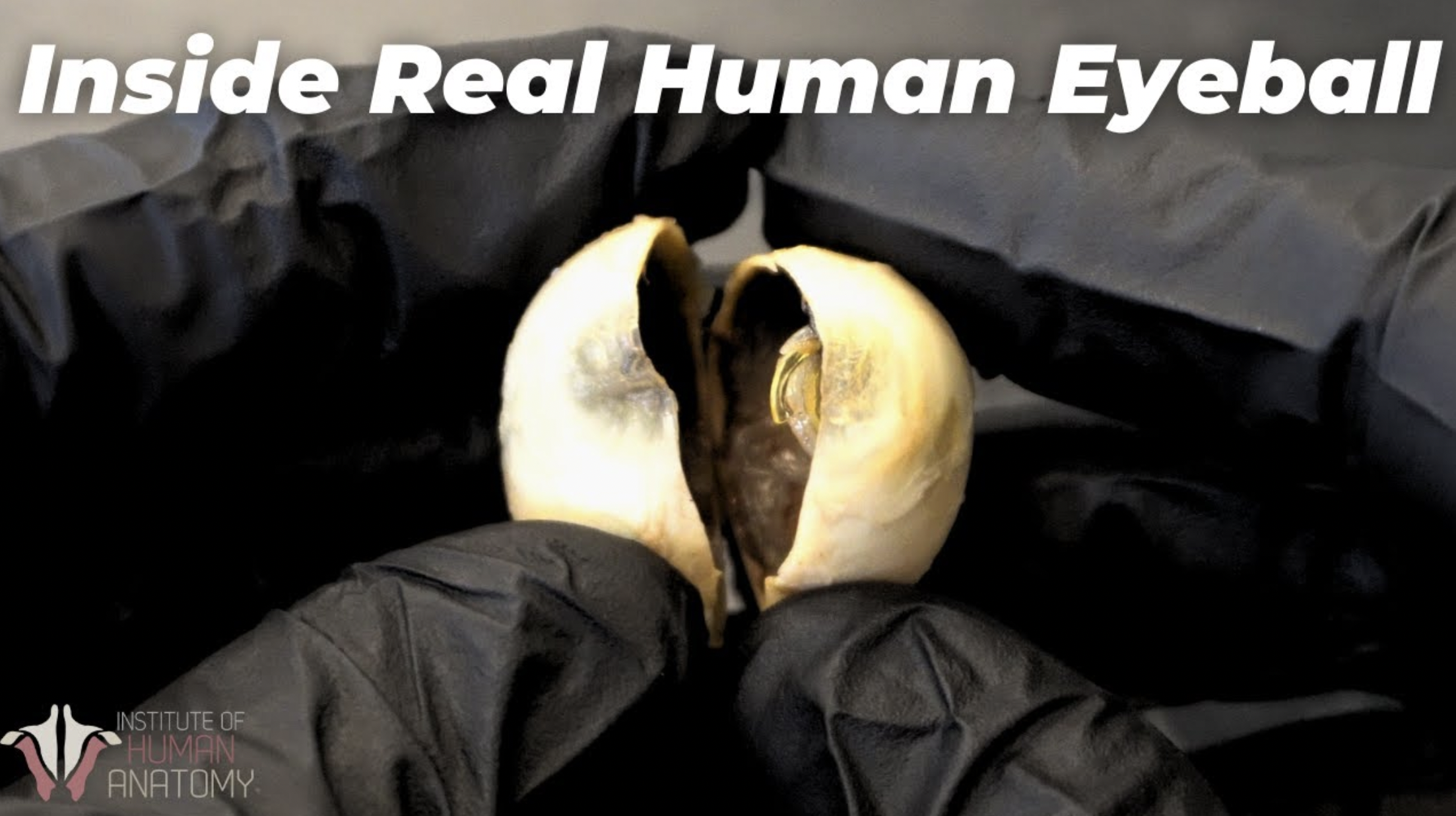 Inside a Human Eyeball: A Fascinating Visual Journey.