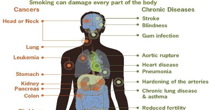 Break the addiction: Tips for quitting smoking on No Tobacco Day.