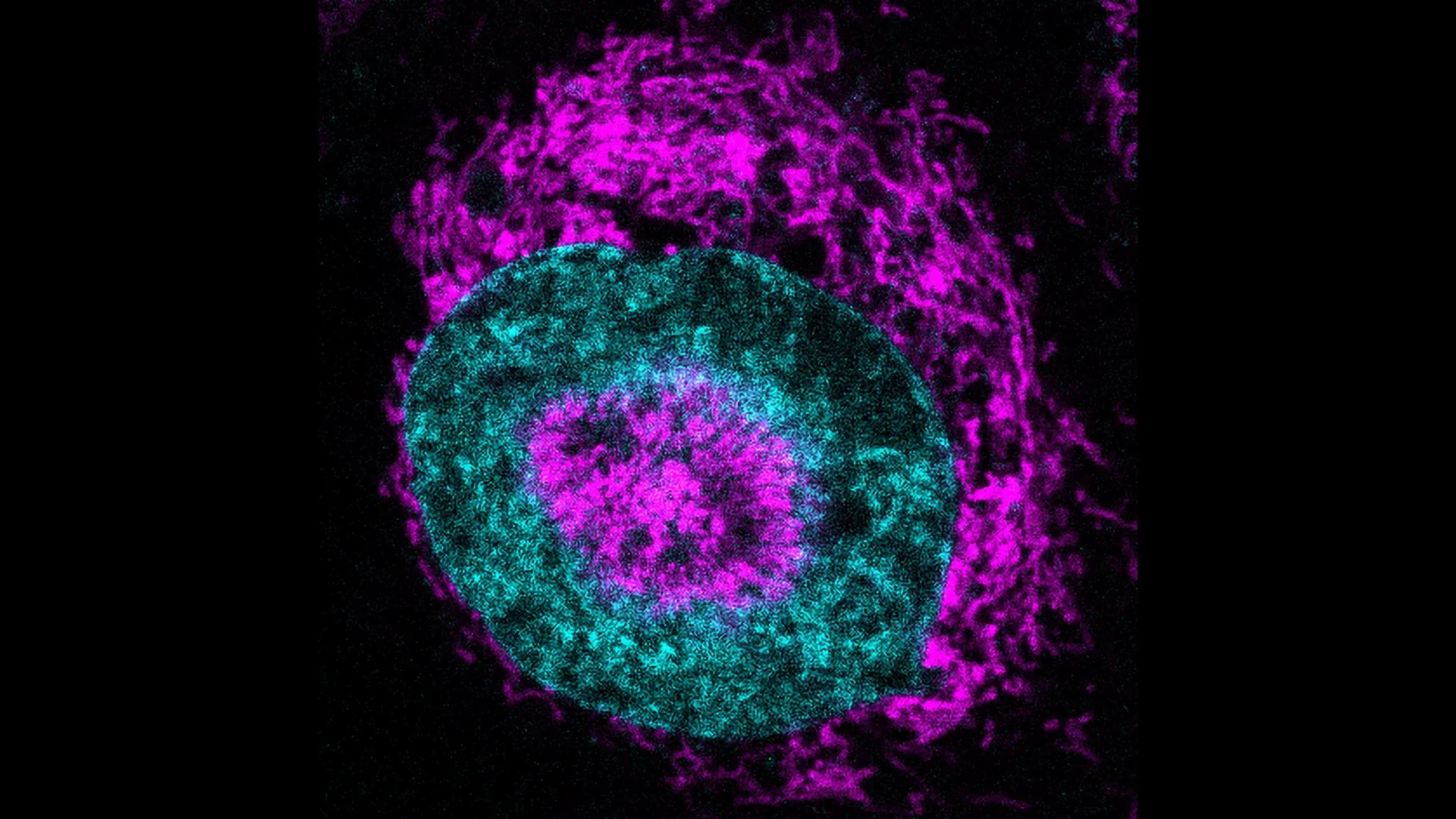 Featured image for Scientists uncover cancer cells' secret energy source
