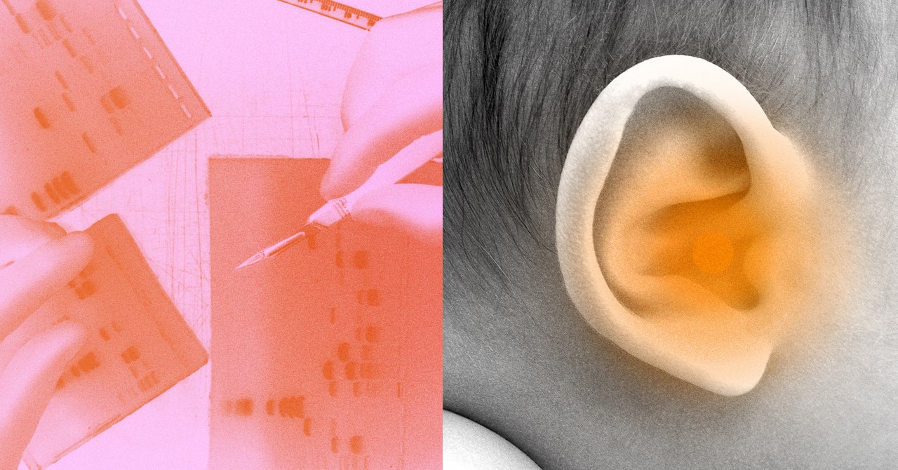 Featured image for "Gene Therapy Restores Hearing in Deaf Children: Breakthrough Treatment Success"