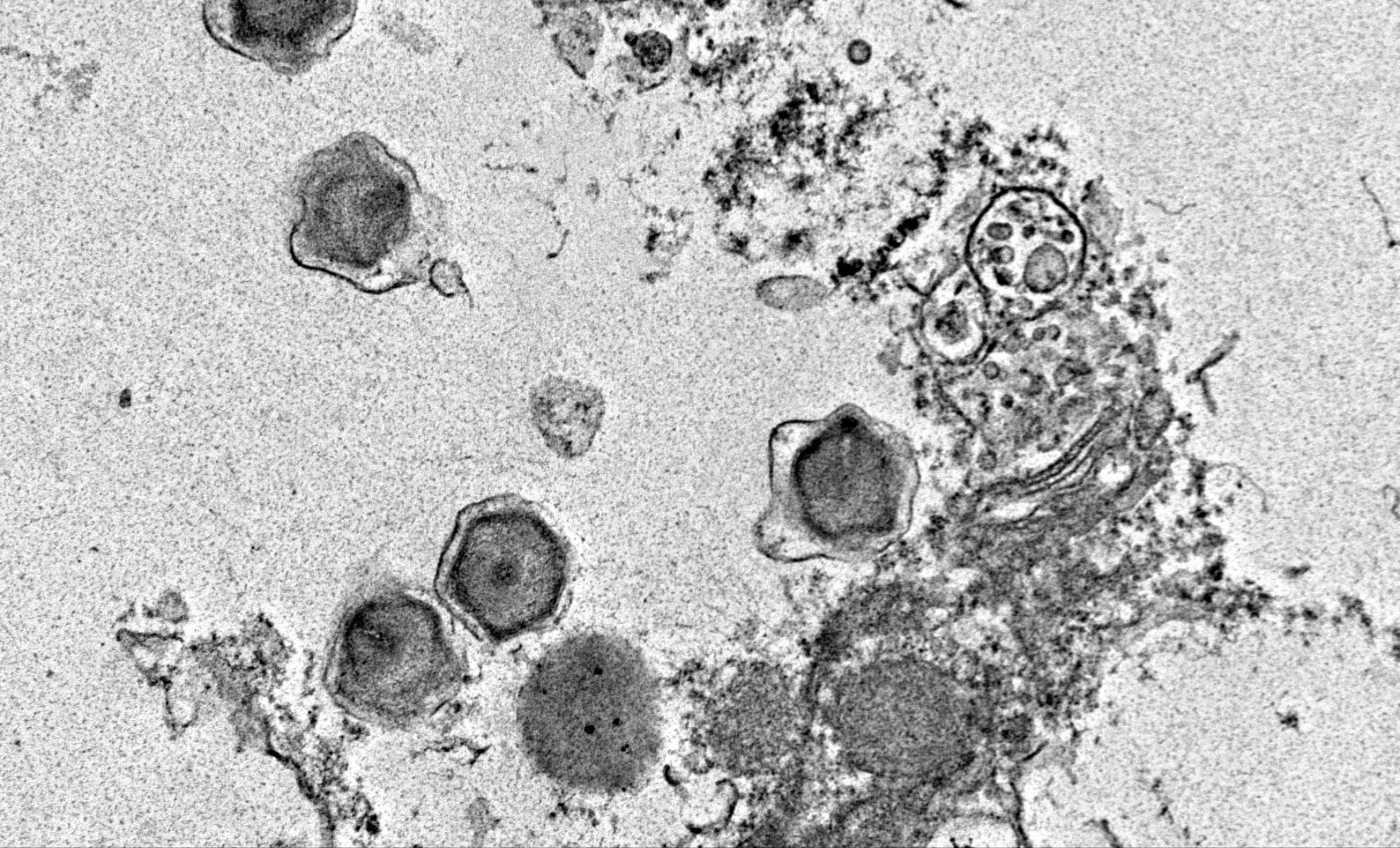 Featured image for Scientists Discover 230 New Giant Viruses Impacting Ocean Ecosystems